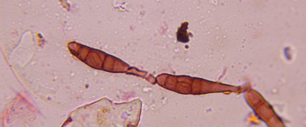 Another microscope image of Alternaria, verified by PollyMap