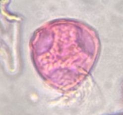 Celtis pollen under a microscope, verified by PollyMap