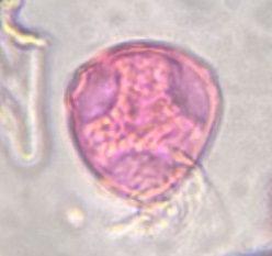 Celtis pollen under a microscope, verified by PollyMap