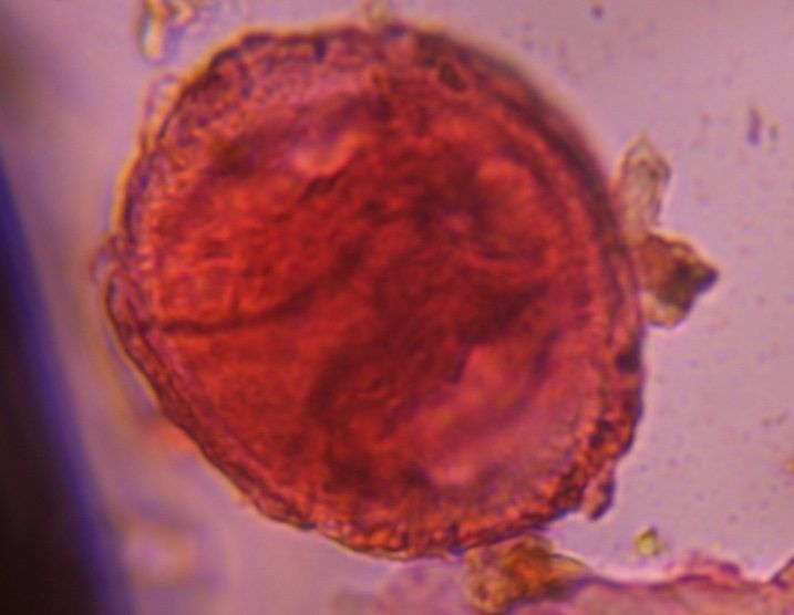 Another microscope image of Pine, verified by PollyMap