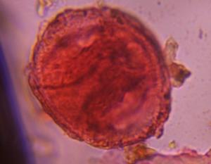 Pine pollen under a microscope, verified by PollyMap