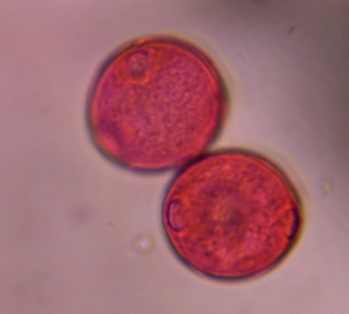 Another microscope image of Cannabis, verified by PollyMap