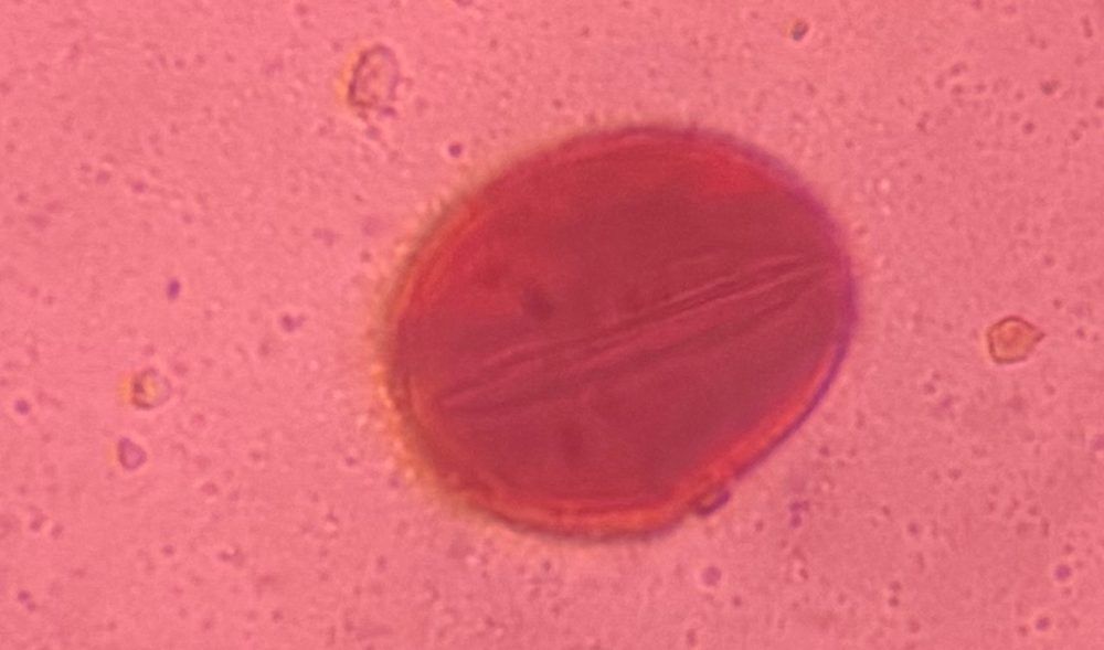 Oak pollen under a microscope, verified by PollyMap
