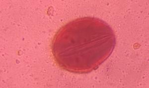 Oak pollen under a microscope, verified by PollyMap