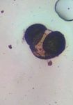 Another microscope image of Pine, verified by PollyMap