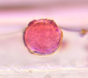 unknown pollen under a microscope, verified by PollyMap