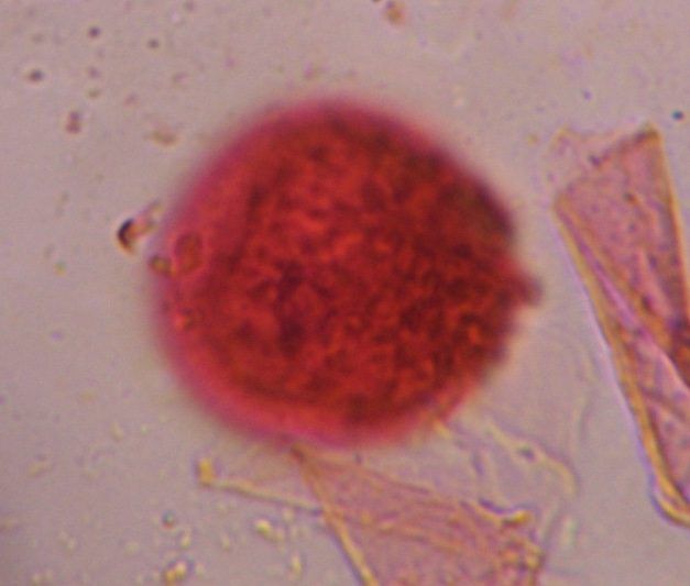 Grass pollen under a microscope, verified by PollyMap