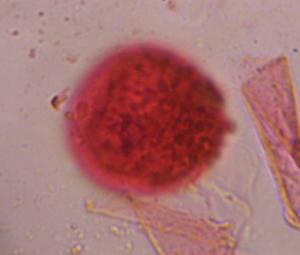 Grass pollen under a microscope, verified by PollyMap