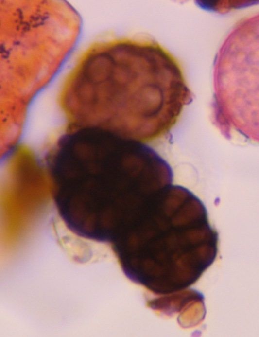 Pithomyces mold spore under a microscope, verified by PollyMap