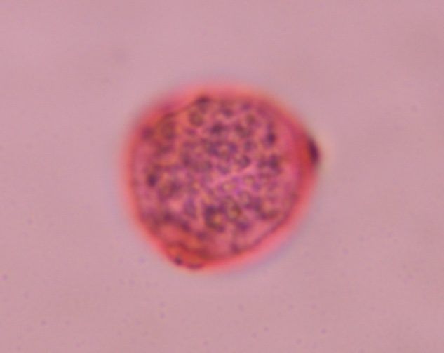 Another microscope image of Cannabis, verified by PollyMap