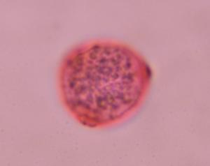 Cannabis pollen under a microscope, verified by PollyMap