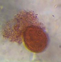 Grass pollen under a microscope, verified by PollyMap