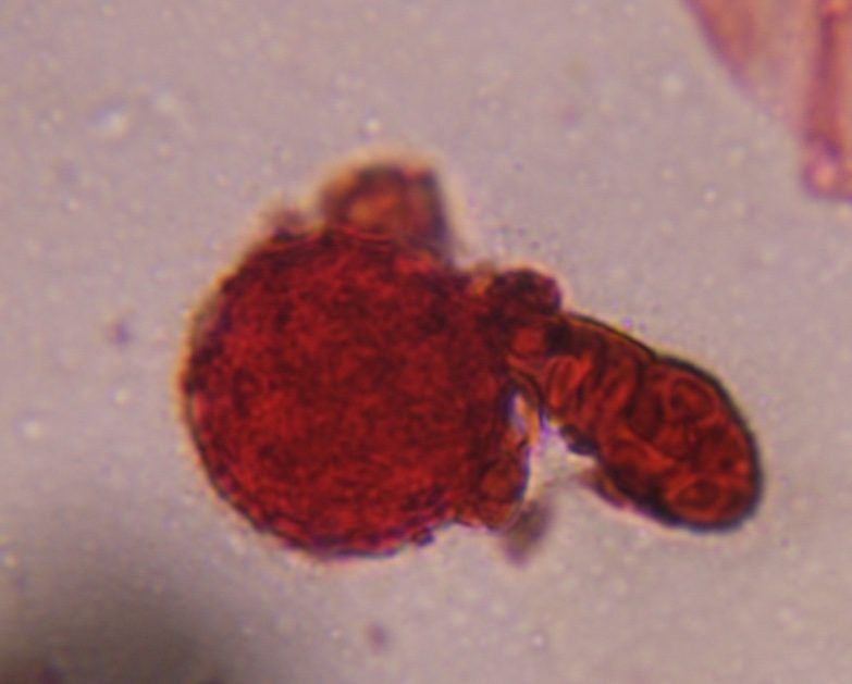 Chenopod pollen under a microscope, verified by PollyMap