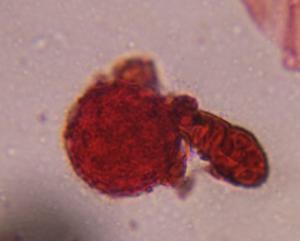 Chenopod pollen under a microscope, verified by PollyMap