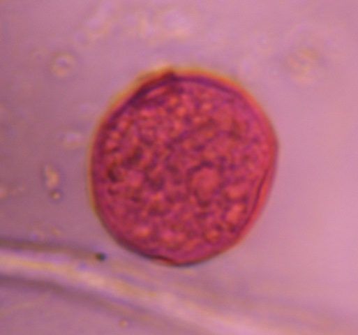 Grass pollen under a microscope, verified by PollyMap