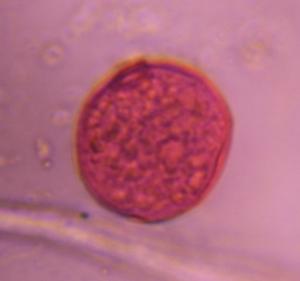 Grass pollen under a microscope, verified by PollyMap