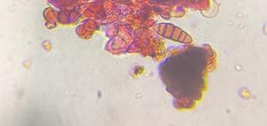 Fungal Spore mold spore under a microscope, verified by PollyMap