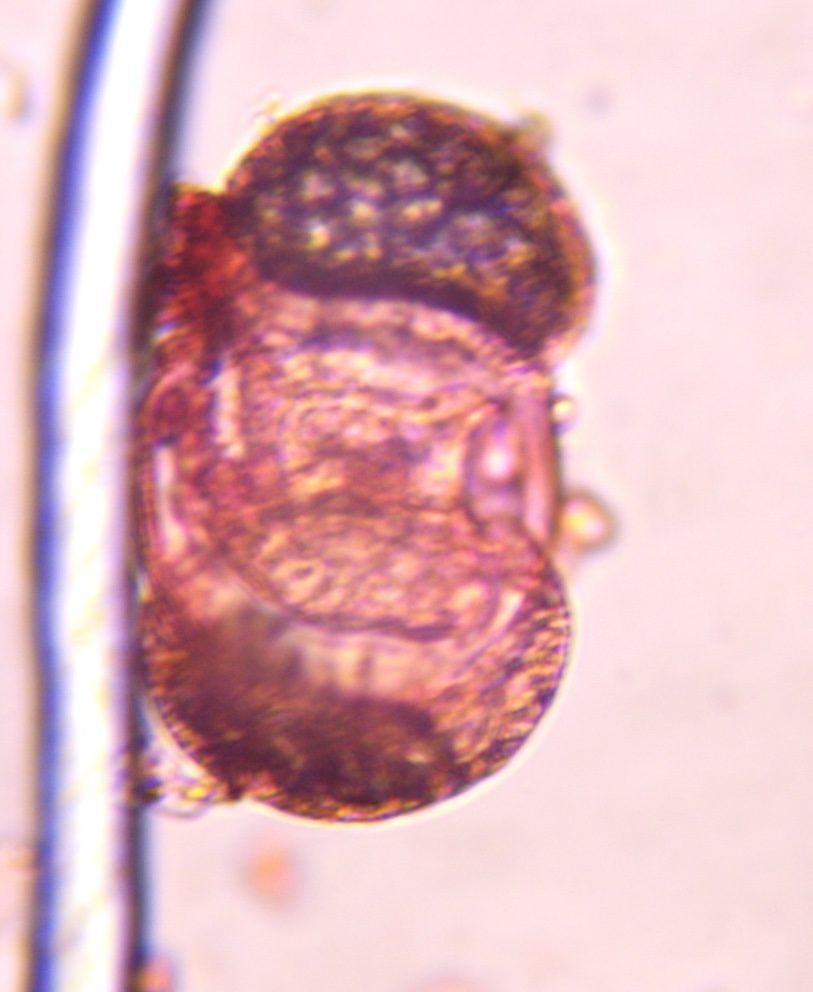 Another microscope image of Pine, verified by PollyMap