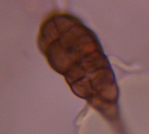 Alternaria mold spore under a microscope, verified by PollyMap