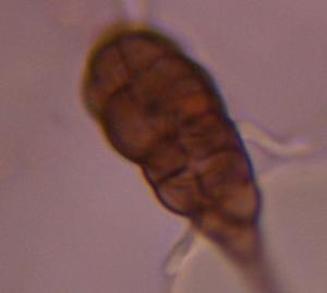 Alternaria mold spore under a microscope, verified by PollyMap