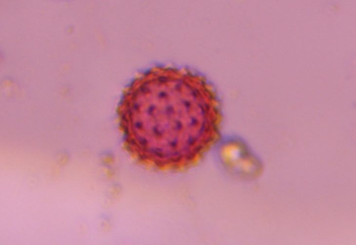 Asteraceae pollen under a microscope, verified by PollyMap