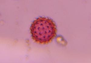 Asteraceae pollen under a microscope, verified by PollyMap