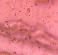 Microscope image of Dust / Particulate Debris, verified by PollyMap