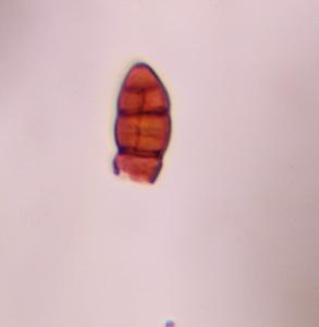alternaria mold spore under a microscope, verified by PollyMap