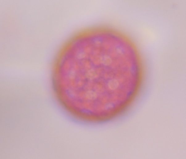 Chenopod pollen under a microscope, verified by PollyMap
