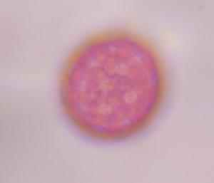 Chenopod pollen under a microscope, verified by PollyMap