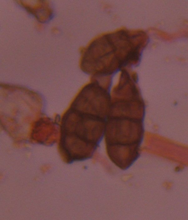 Alternaria mold spore under a microscope, verified by PollyMap