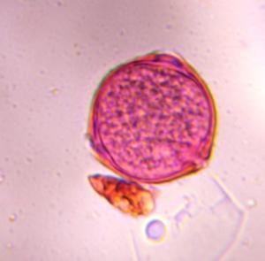 Urticaceae pollen under a microscope, verified by PollyMap