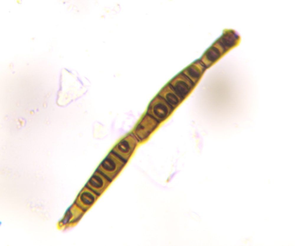 Bipolaris/Drechslera-type mold spore under a microscope, verified by PollyMap