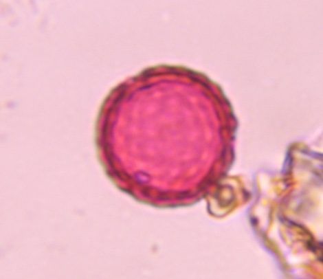 Another microscope image of Chenopod, verified by PollyMap