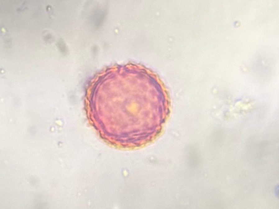Another microscope image of Asteraceae, verified by PollyMap