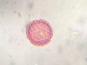 Asteraceae pollen under a microscope, verified by PollyMap