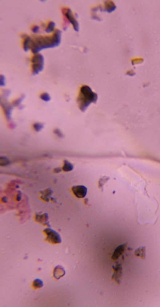 Microscope image of Debris, verified by PollyMap