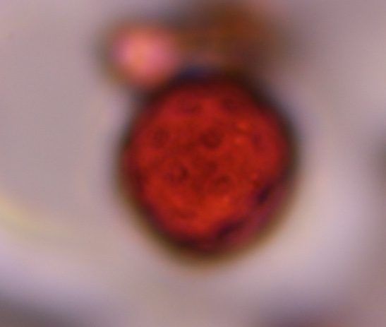Chenopod pollen under a microscope, verified by PollyMap