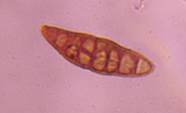 Another microscope image of Alternaria, verified by PollyMap