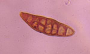 Alternaria mold spore under a microscope, verified by PollyMap
