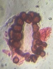 Microscope image of Fern sporangium, verified by PollyMap