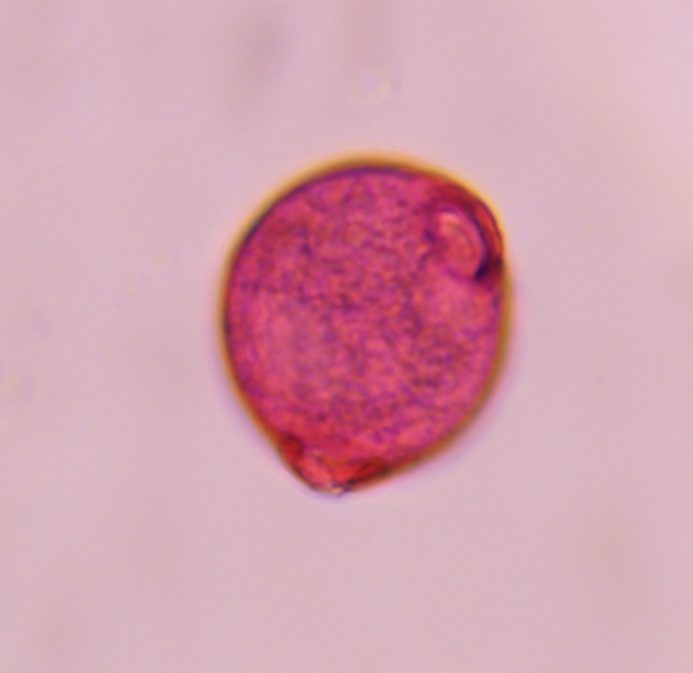 Urticaceae pollen under a microscope, verified by PollyMap