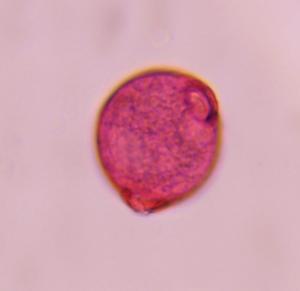 Urticaceae pollen under a microscope, verified by PollyMap