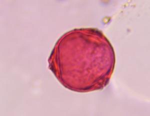 Celtis pollen under a microscope, verified by PollyMap