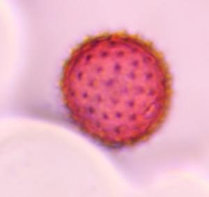 Asteraceae pollen under a microscope, verified by PollyMap