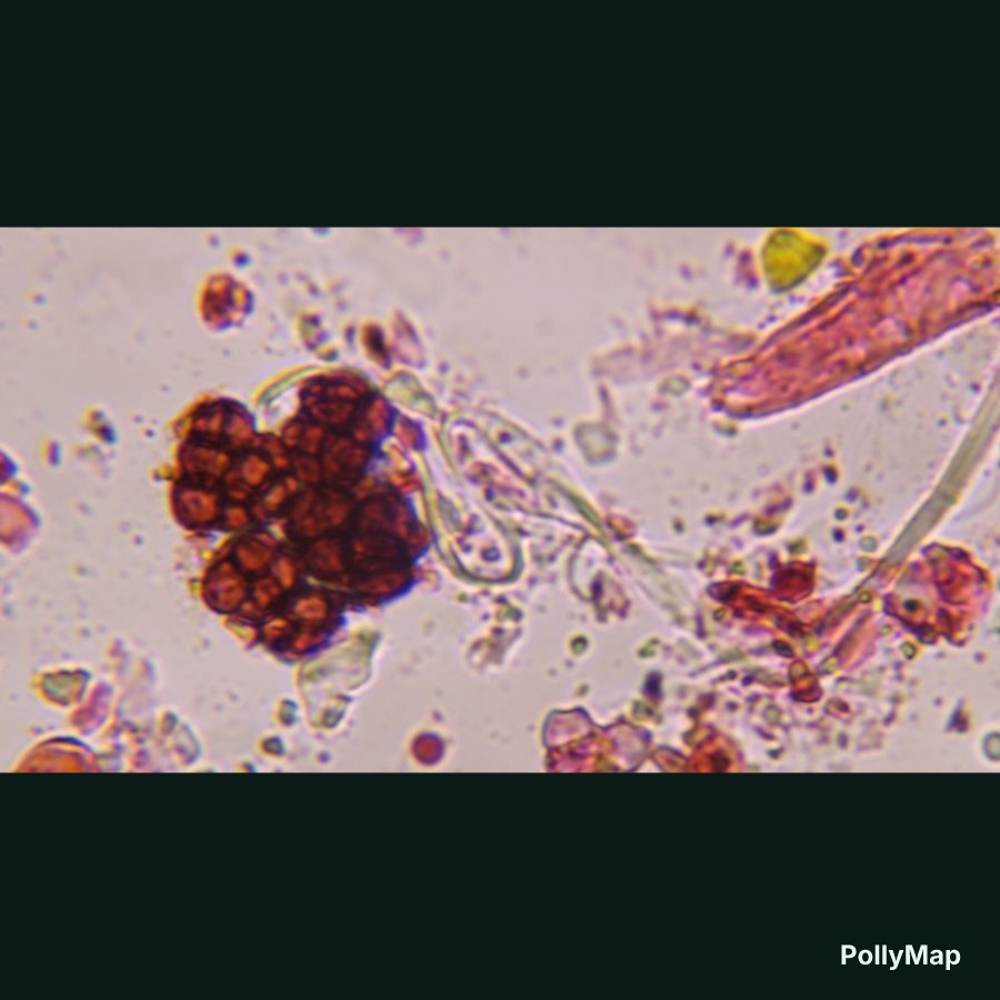Microscope image of Epicoccum, verified by PollyMap