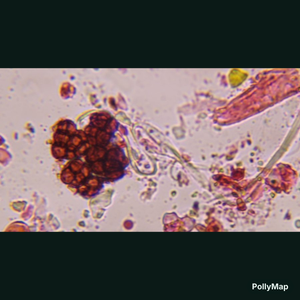 Epicoccum mold spore under a microscope, verified by PollyMap