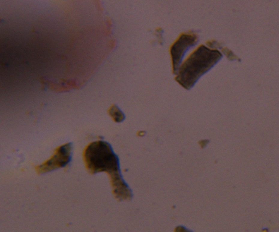 Particulate house dust under a microscope, verified by PollyMap