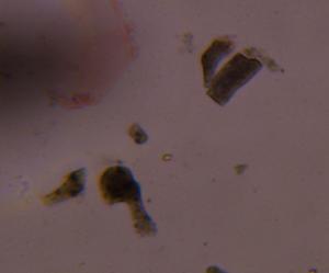 Particulate house dust under a microscope, verified by PollyMap