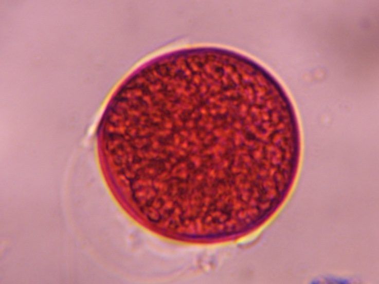 Another microscope image of Poaceae, verified by PollyMap